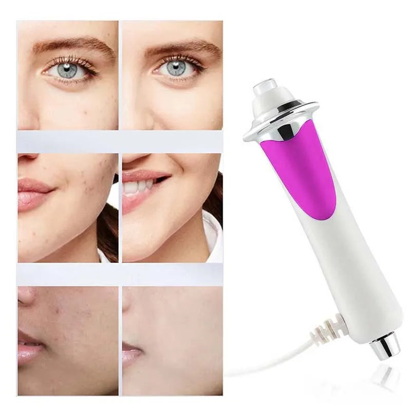Rf Radio Frequency Face Lifting Ems Microcurrent Mesotherapy Skin Tightening Anti Wrinkle Skin Rejuvenation Beauty Oxygen Pen