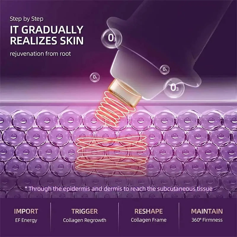 Rf Radio Frequency Face Lifting Ems Microcurrent Mesotherapy Skin Tightening Anti Wrinkle Skin Rejuvenation Beauty Oxygen Pen